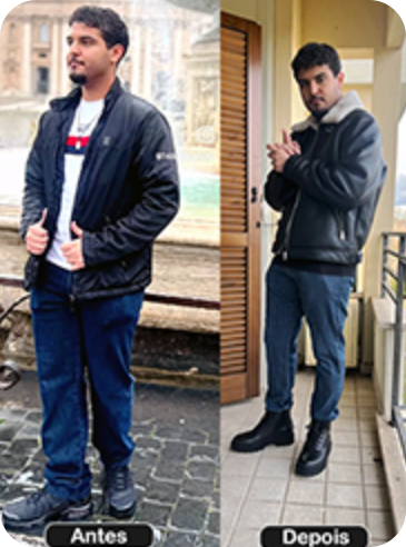 ANTES E DPS 1