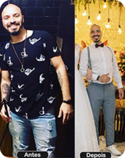 ANTES E DPS 4